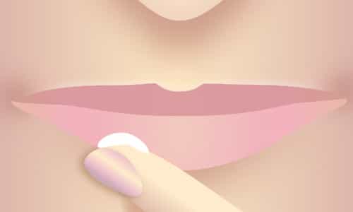 Anwendung von Lippencreme bei Lippenherpes